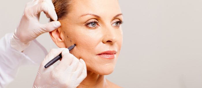 cosmetic surgeon drawing lines on senior woman face for plastic surgery close up